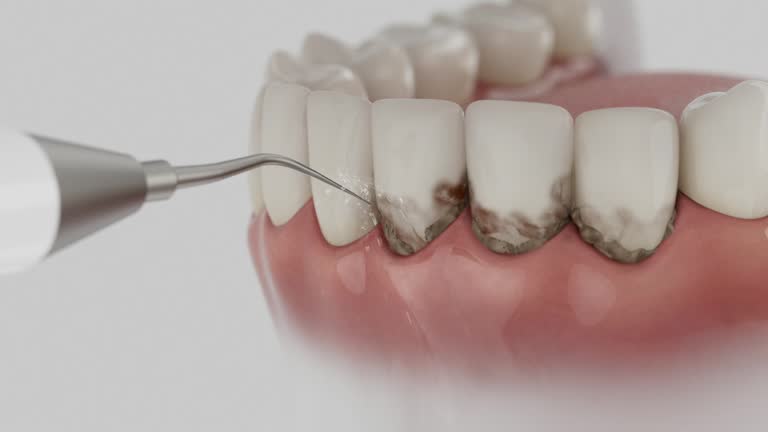 Reliable Dental contractor in Avoca, PA by Dentist Open Now